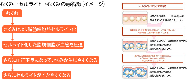 むくみ→セルライト→むくみの悪循環